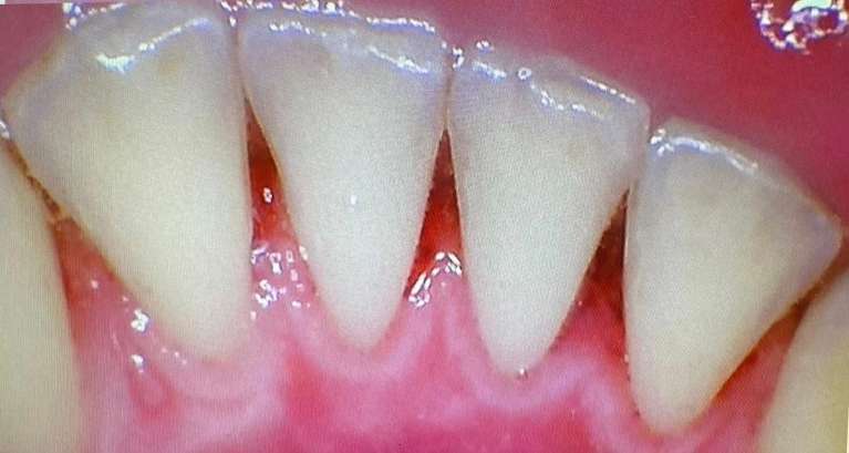 Hygiene-After-Image