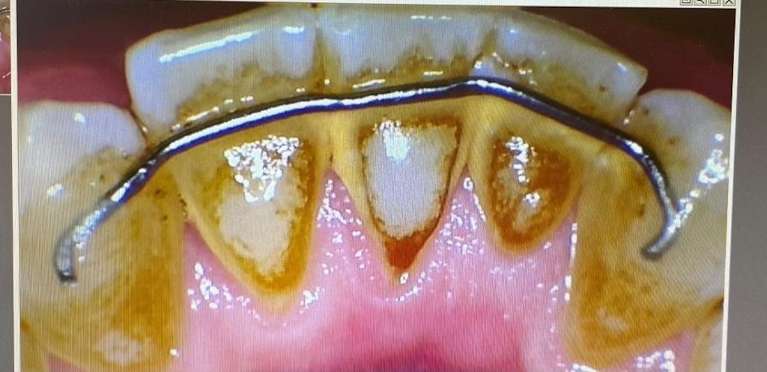 Hygiene-Before-Image