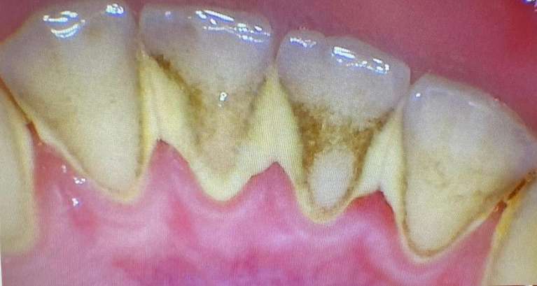 Hygiene-Before-Image